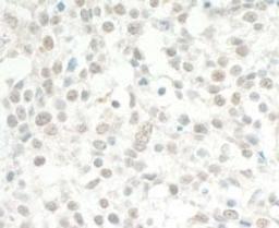 Detection of human MED13L by immunohistochemistry.