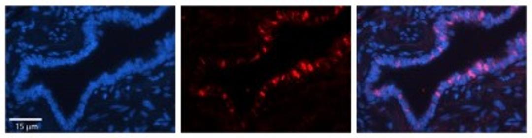 Immunocytochemistry/Immunofluorescence: Exportin-T Antibody [NBP1-57176] - Formalin Fixed Paraffin; Embedded Tissue: Human Bronchial Epithelial Tissue; Observed Staining: Cytoplasmic and nuclear; Primary Antibody Concentration: 1:100