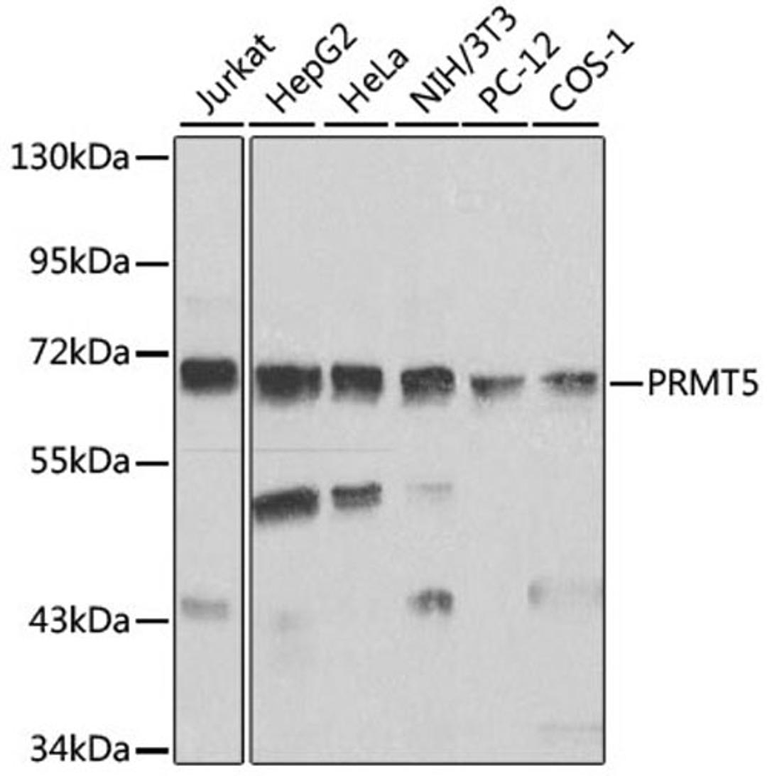 Western blot - PRMT5 antibody (A1520)