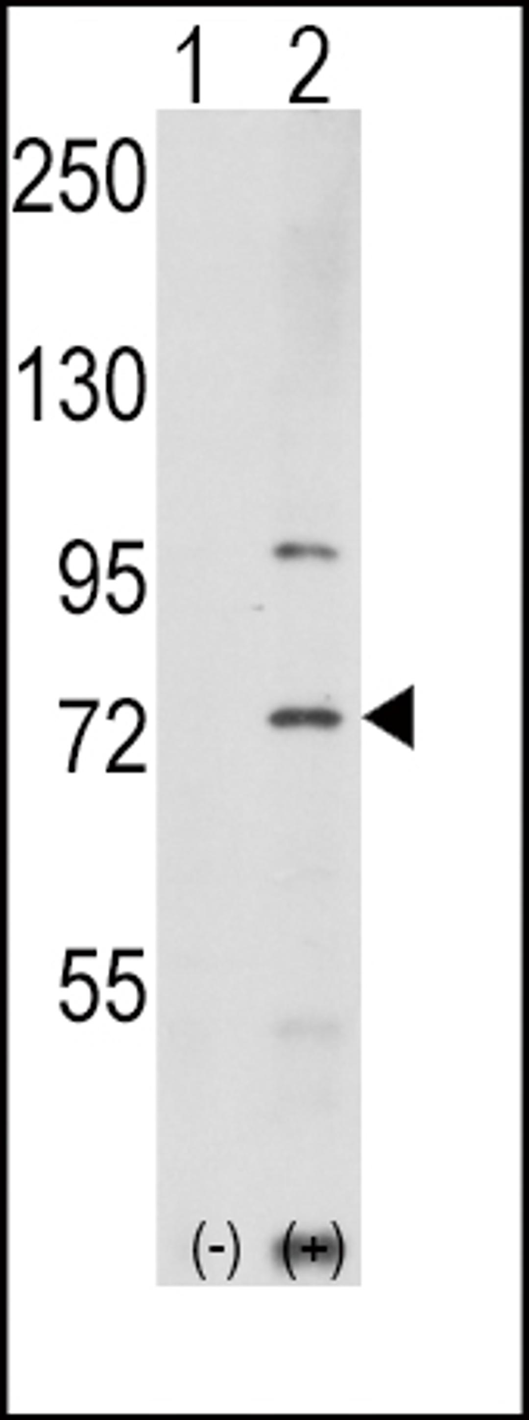 Western blot analysis of PAK1 using rabbit polyclonal PAK1 Antibody (T423).293 cell lysates (2 ug/lane) either nontransfected (Lane 1) or transiently transfected with the PAK1 gene (Lane 2).