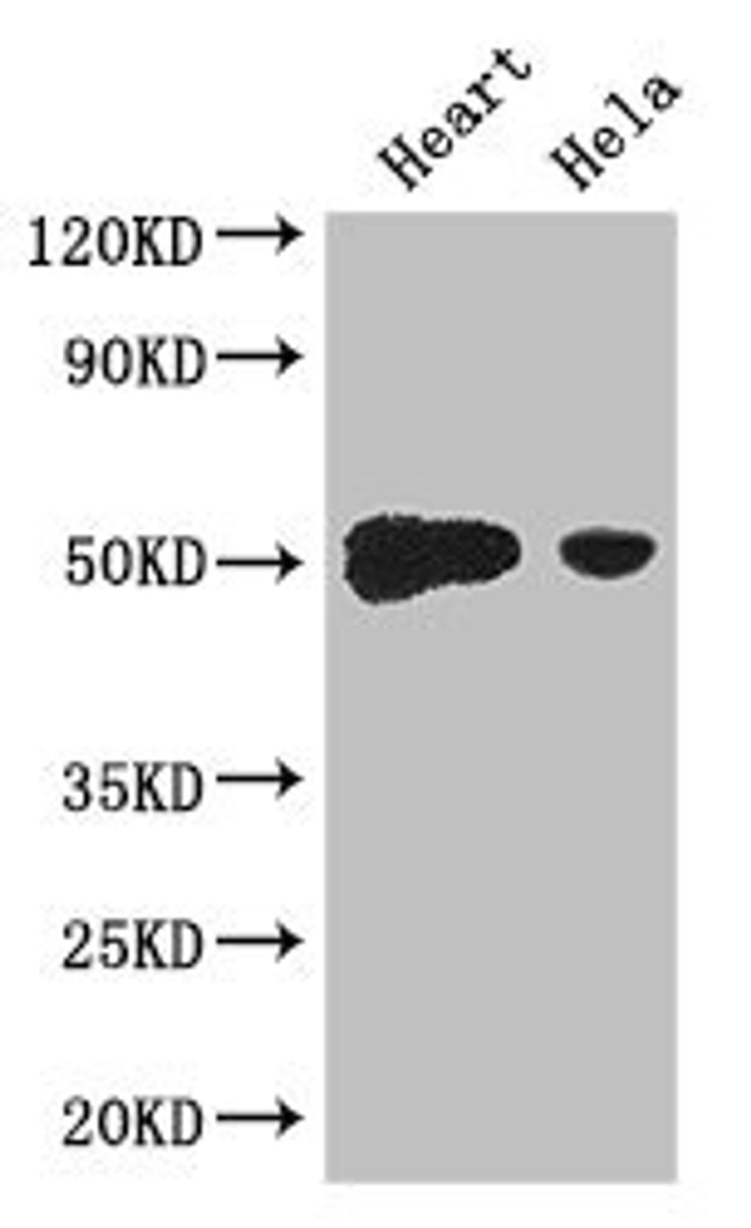 Western Blot. Positive WB detected in: Mouse heart tissue, Hela whole cell lysate. All lanes: TFDP2 antibody at 3.2ug/ml. Secondary. Goat polyclonal to rabbit IgG at 1/50000000 dilution. Predicted band size: 50, 41, 42, 43, 40, 35, 47 kDa. Observed band size: 50 kDa.