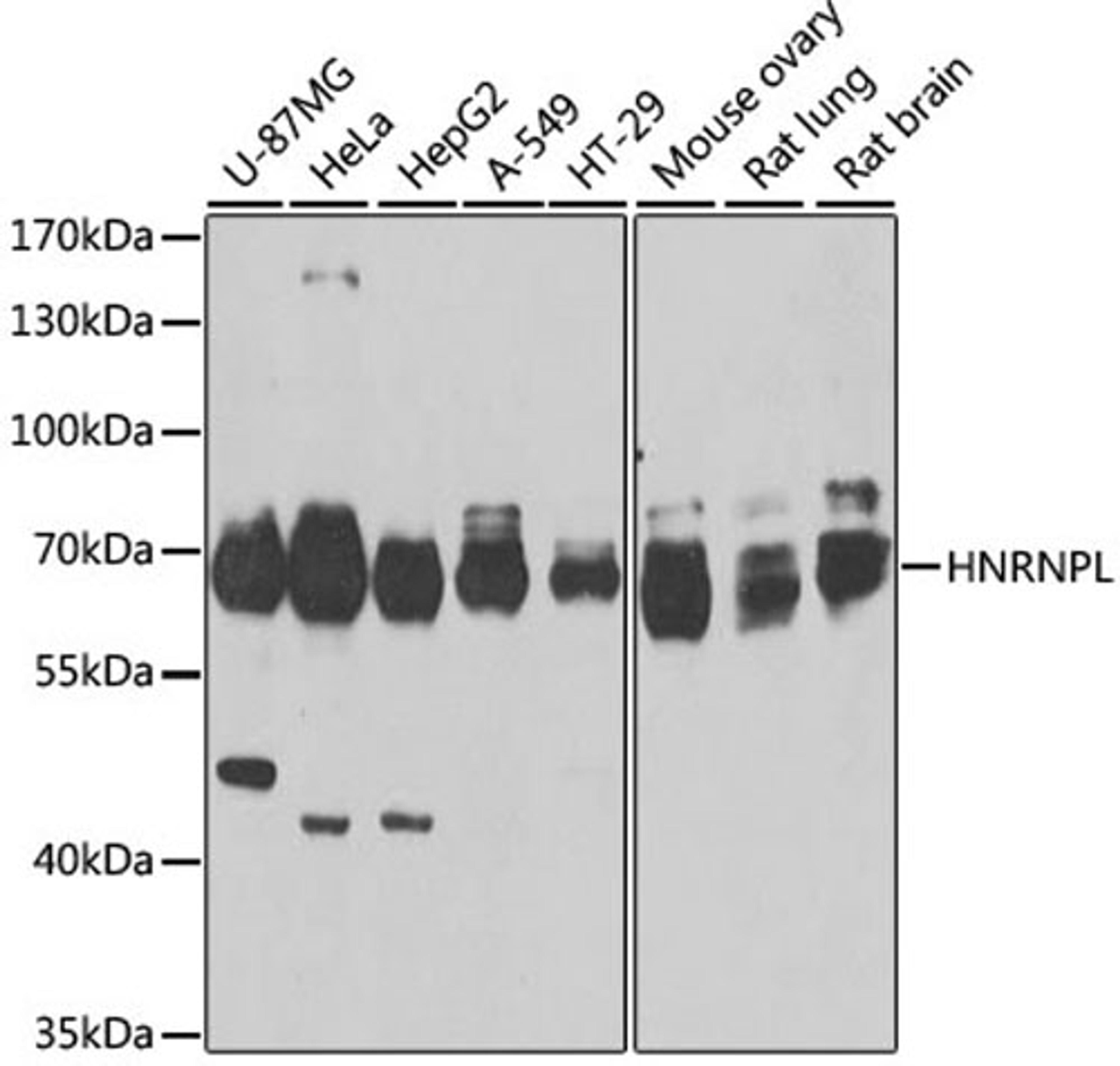 Western blot - HNRNPL antibody (A8430)