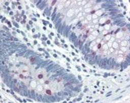 Immunohistochemistry staining of STAT5 in colon tissue using STAT5 Antibody.