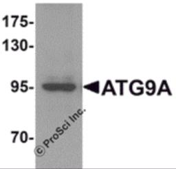 Western blot analysis of ATG9A in mouse heart tissue lysate with ATG9A antibody at 1 &#956;g/mL.