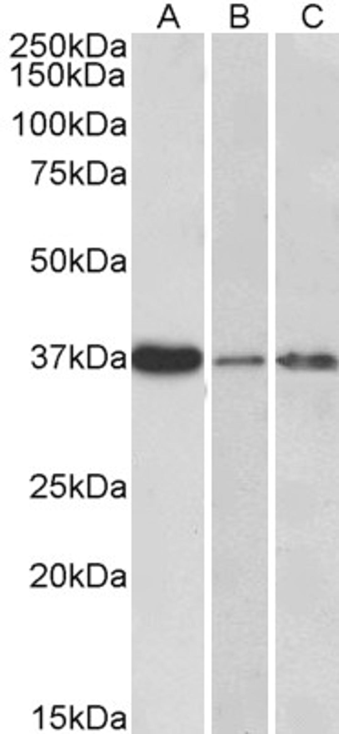 45-767 (0.3ug/ml) staining of Human Liver (A), Skin (B) and Tonsil (C) lysate (35ug protein in RIPA buffer). Primary incubation was 1 hour. Detected by chemiluminescence.