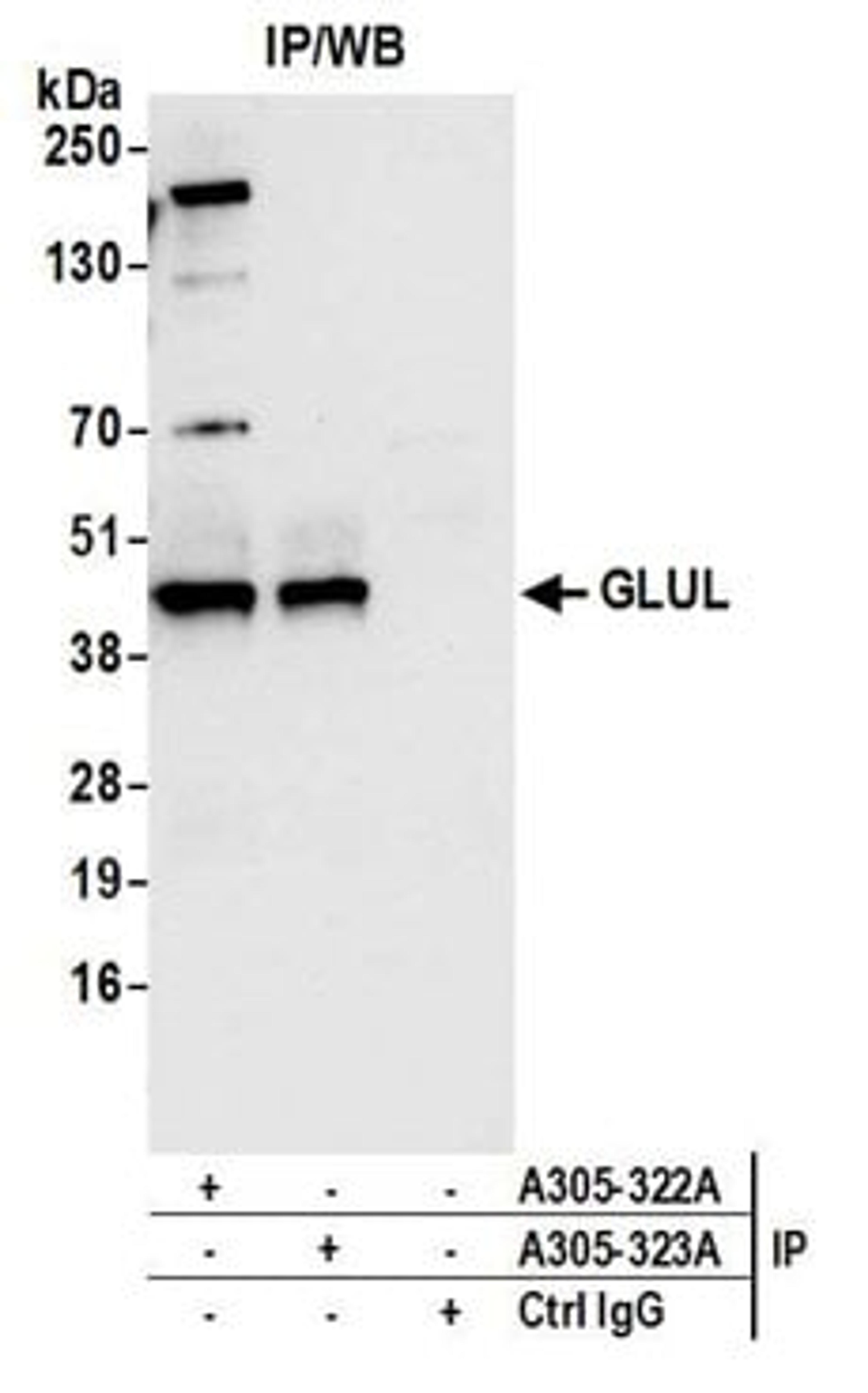 Detection of human GLUL by western blot of immunoprecipitates.