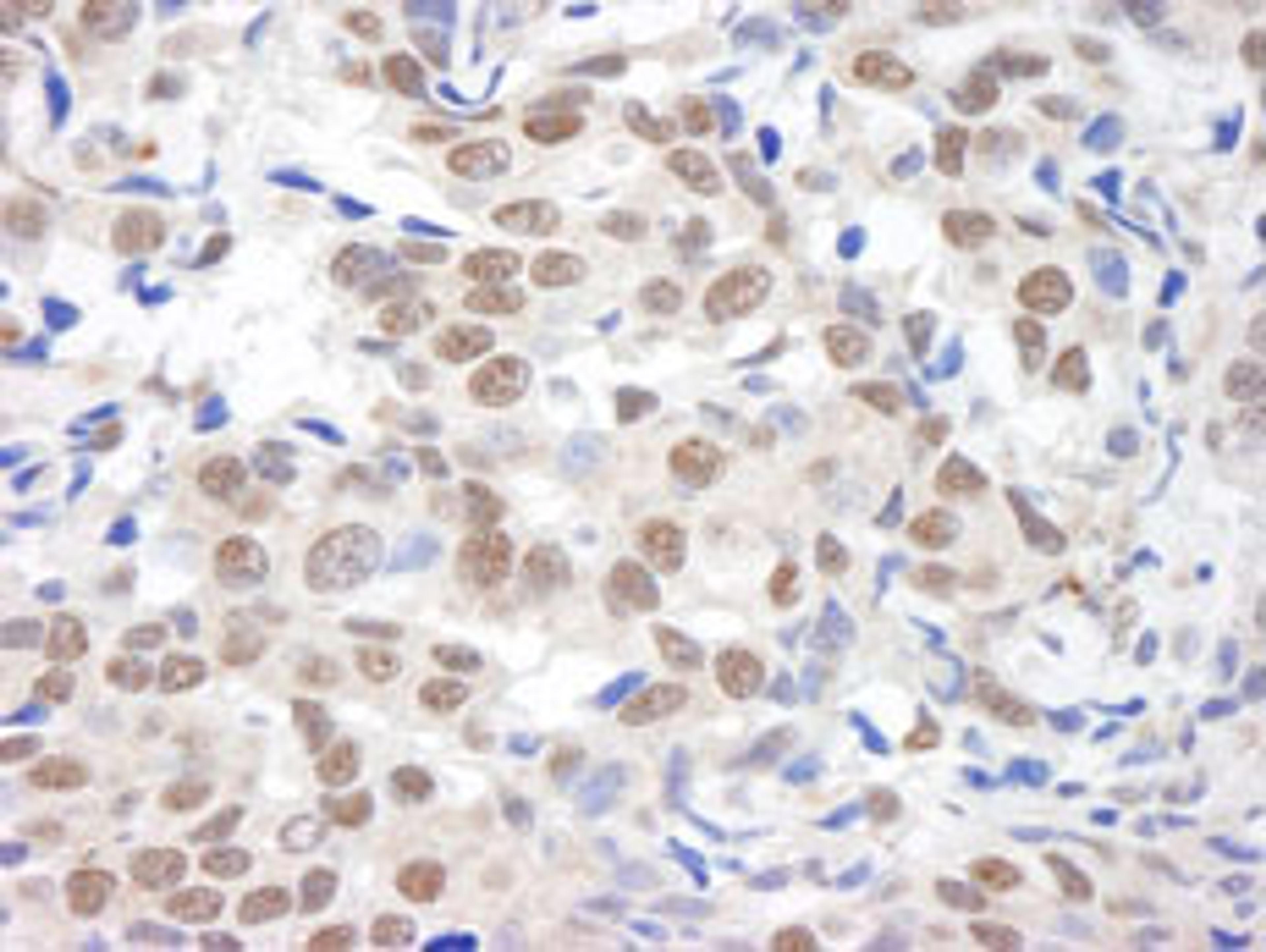 Detection of human BHC110/LSD1 by immunohistochemistry.