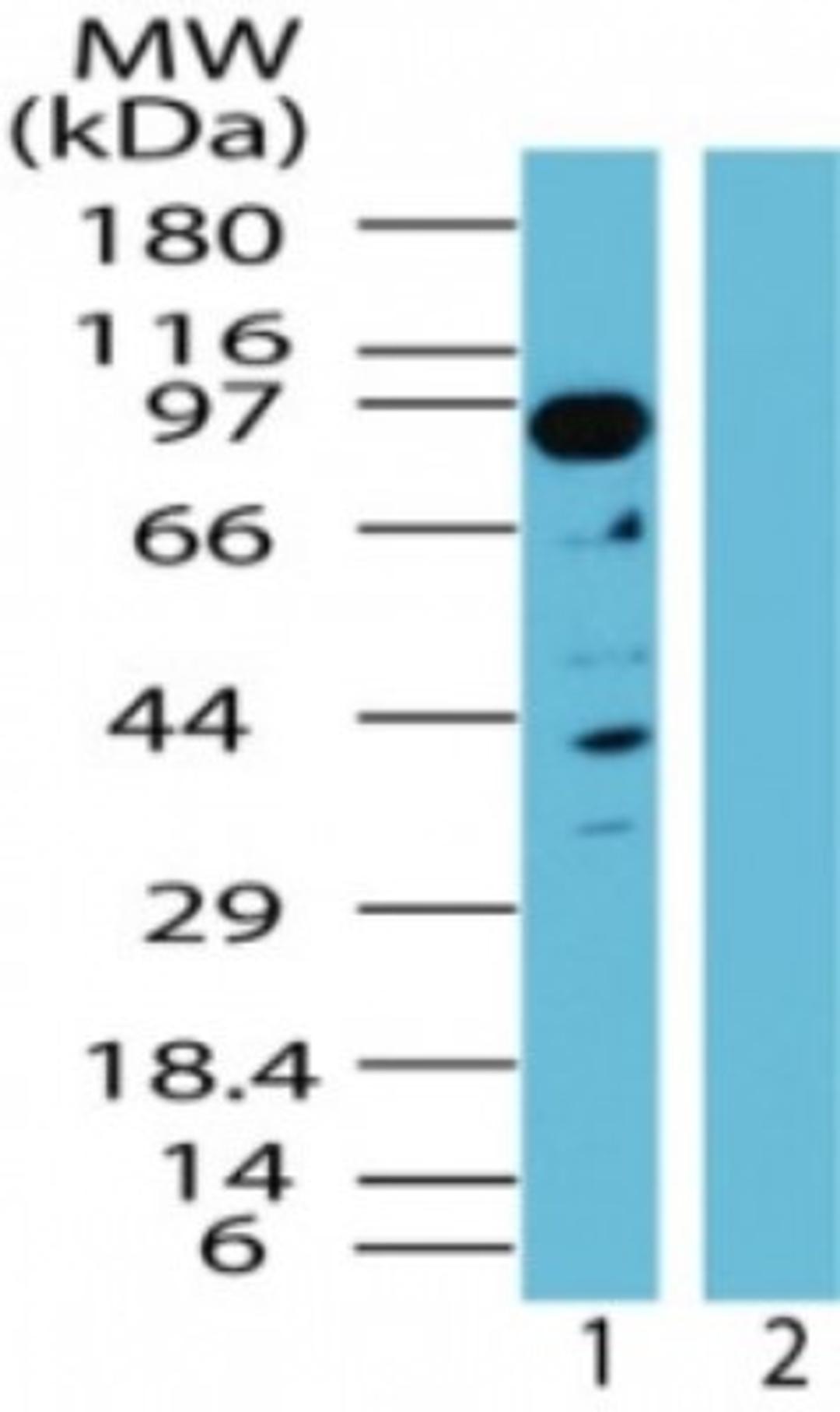 Western Blot: NAP1 Antibody [NBP2-24727] - Western blot analysis of NAP1 in human kidney lysate in the 1) absence and 2) presence of immunizing peptide using NBP2-24727 at 0.5 ug/ml.