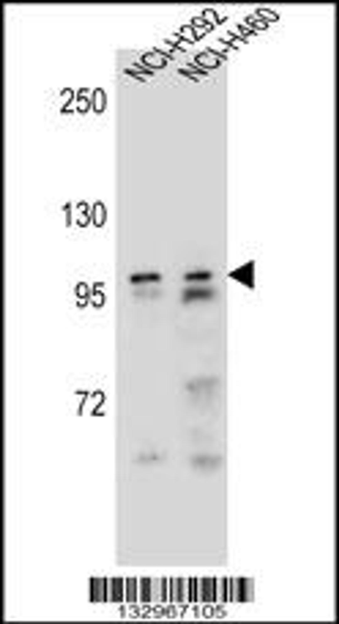 Western blot analysis in NCI-H292,NCI-H460 cell line lysates (35ug/lane).This demonstrates the detected the AR protein (arrow).