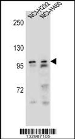 Western blot analysis in NCI-H292,NCI-H460 cell line lysates (35ug/lane).This demonstrates the detected the AR protein (arrow).