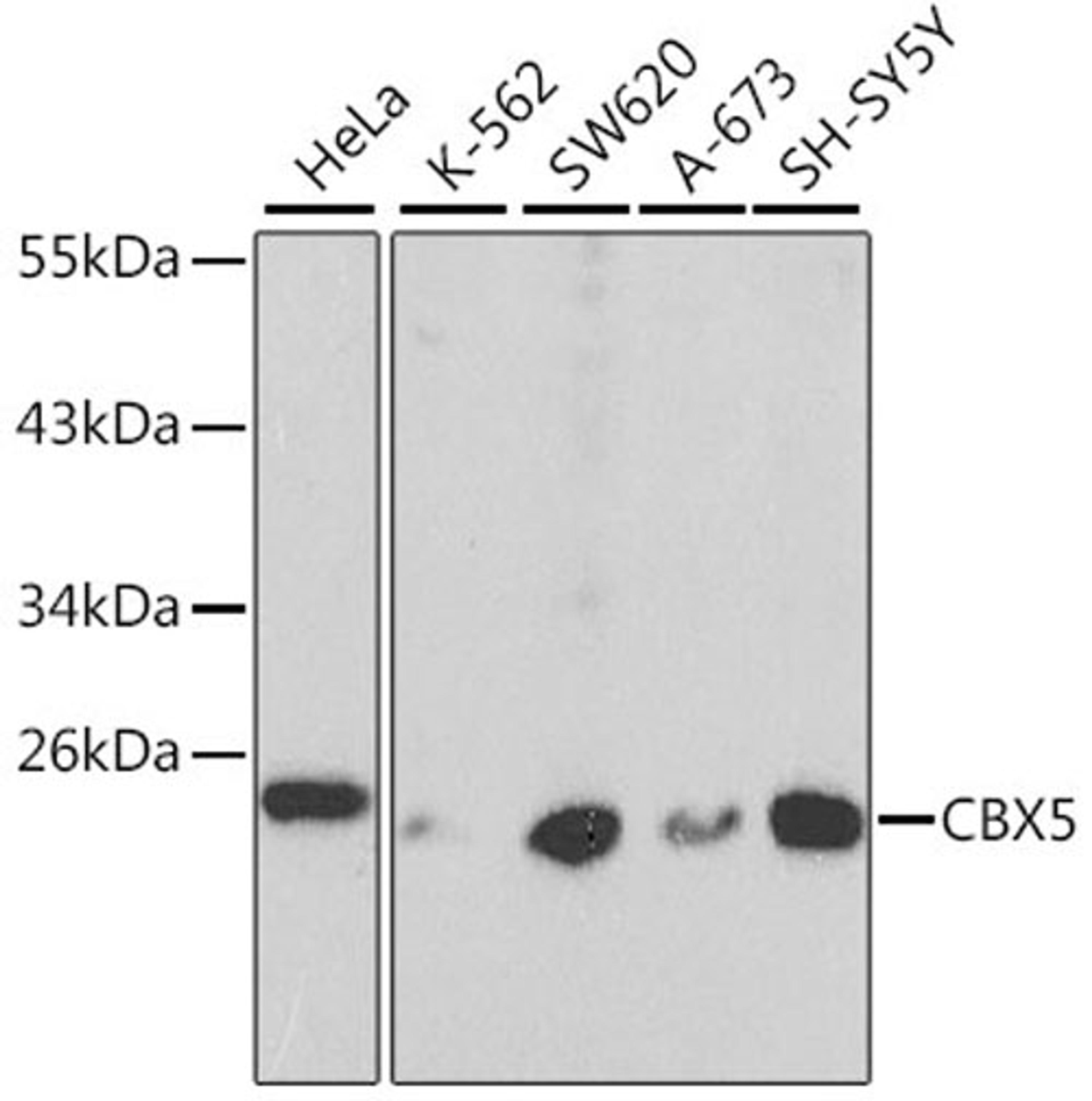 Western blot - CBX5 antibody (A1098)