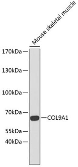 Western blot - COL9A1 antibody (A6563)