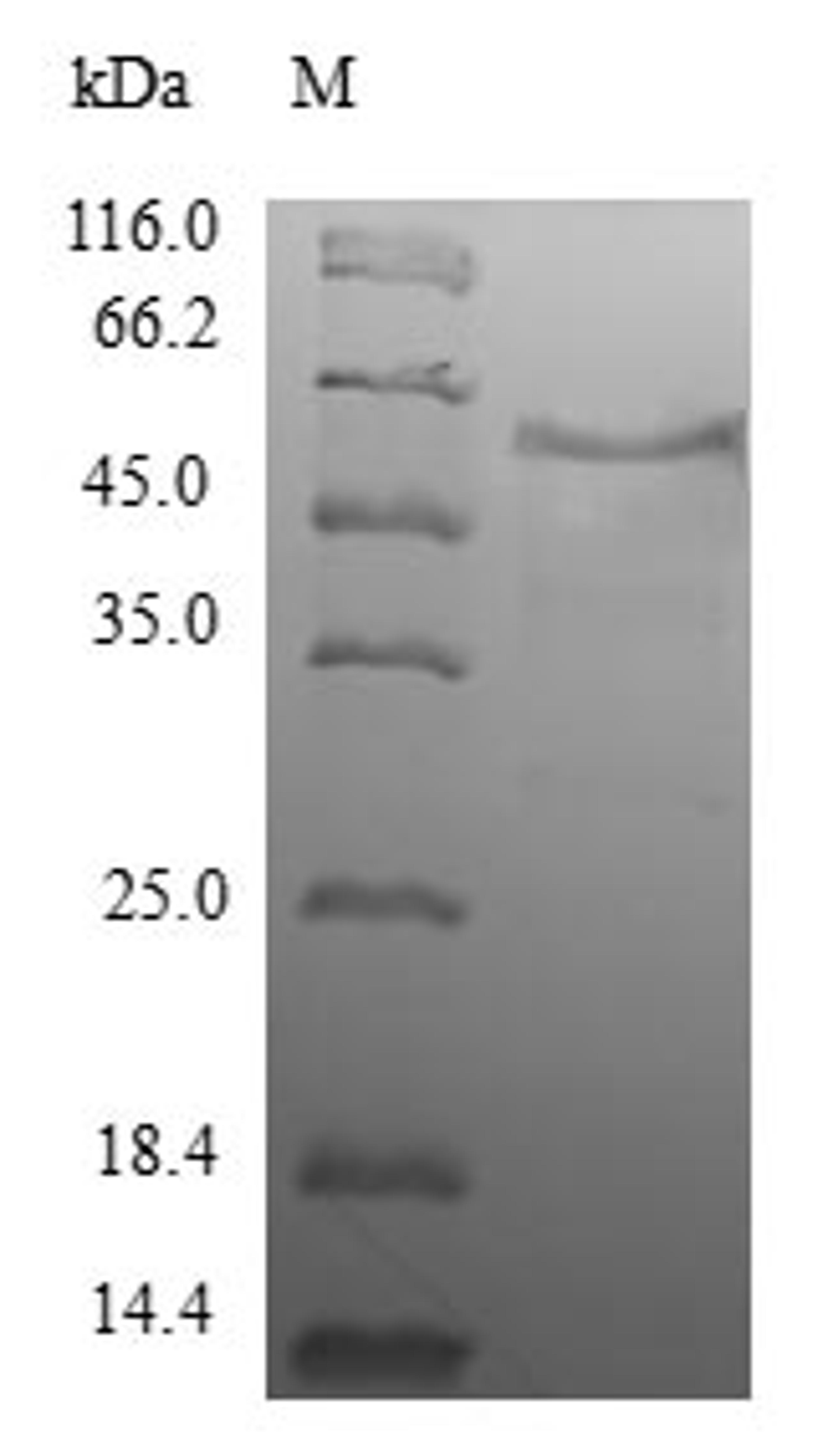 (Tris-Glycine gel) Discontinuous SDS-PAGE (reduced) with 5% enrichment gel and 15% separation gel.