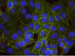 Proximity Ligation Assay: TopBP1 Antibody [NB100-217] - Secondary-conjugate Duolink in Situ PLA in Hela cells. goat anti-human CHK1 (NB100-311) and rabbit anti-human  TopBP1 (NB100-217). Image merged from DAPI (2ms), FITC/Green (25ms) and TRITC/Orange (250ms) exposures, 40X magnification. Control images may not have counterstained cytoplasm.