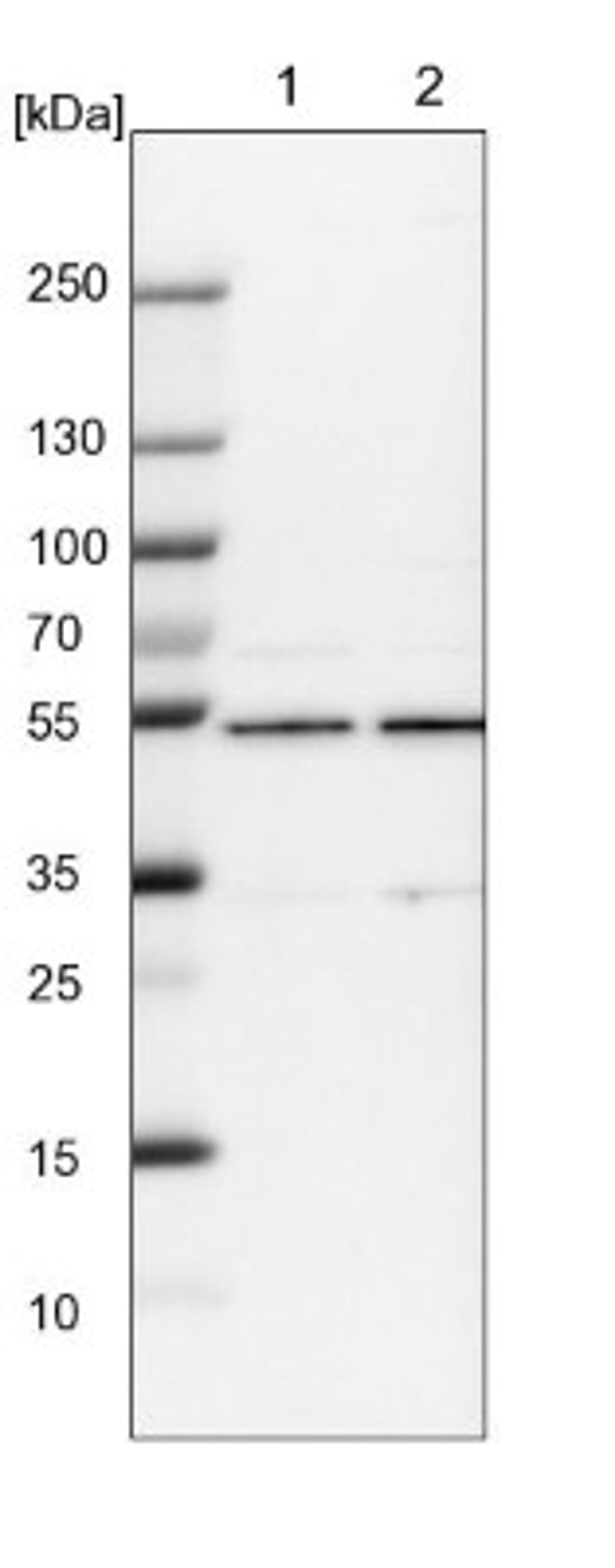 Western Blot: Carbohydrate Sulfotransferase 15/CHST15 Antibody [NBP1-88367] - Lane 1: NIH-3T3 cell lysate (Mouse embryonic fibroblast cells)<br/>Lane 2: NBT-II cell lysate (Rat Wistar bladder tumour cells)