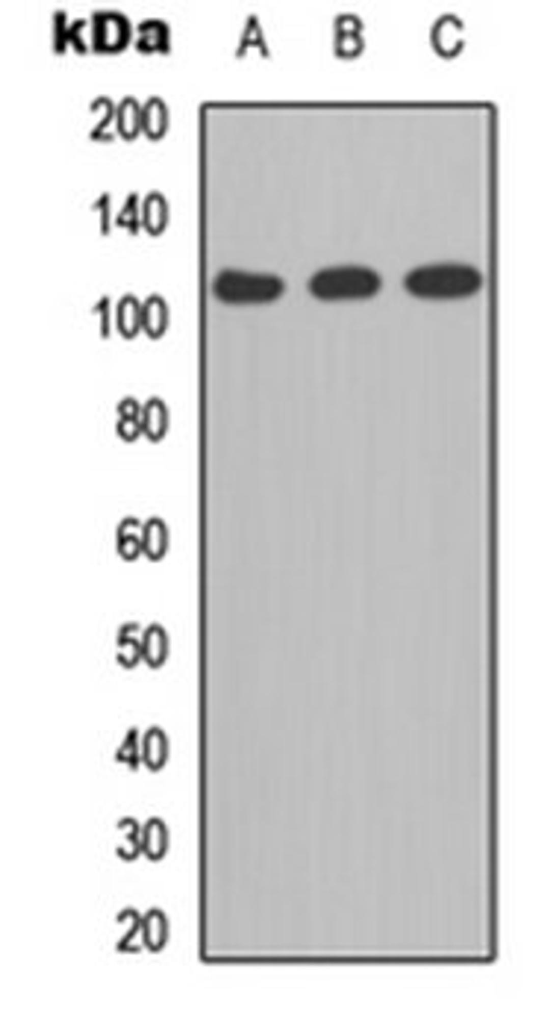 Western blot analysis of A549 (Lane 1), MCF7 (Lane 2), PC12 (Lane 3) whole cell lysates using CD41 LC 1 antibody