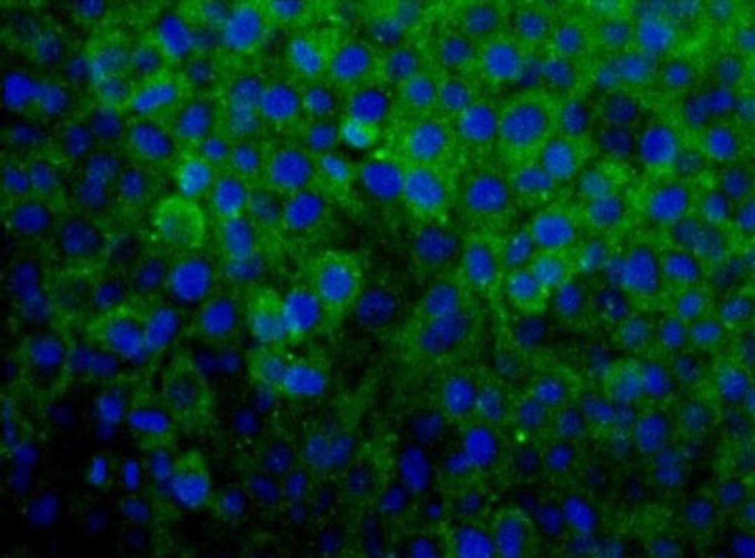 Immunocytochemistry/Immunofluorescence: SNX27 Antibody [NBP1-45283] - Detection of SNX27 (Green) in Hela cells using NBP1-45283.  Nuclei (Blue) are counterstained using Hoechst 33258.