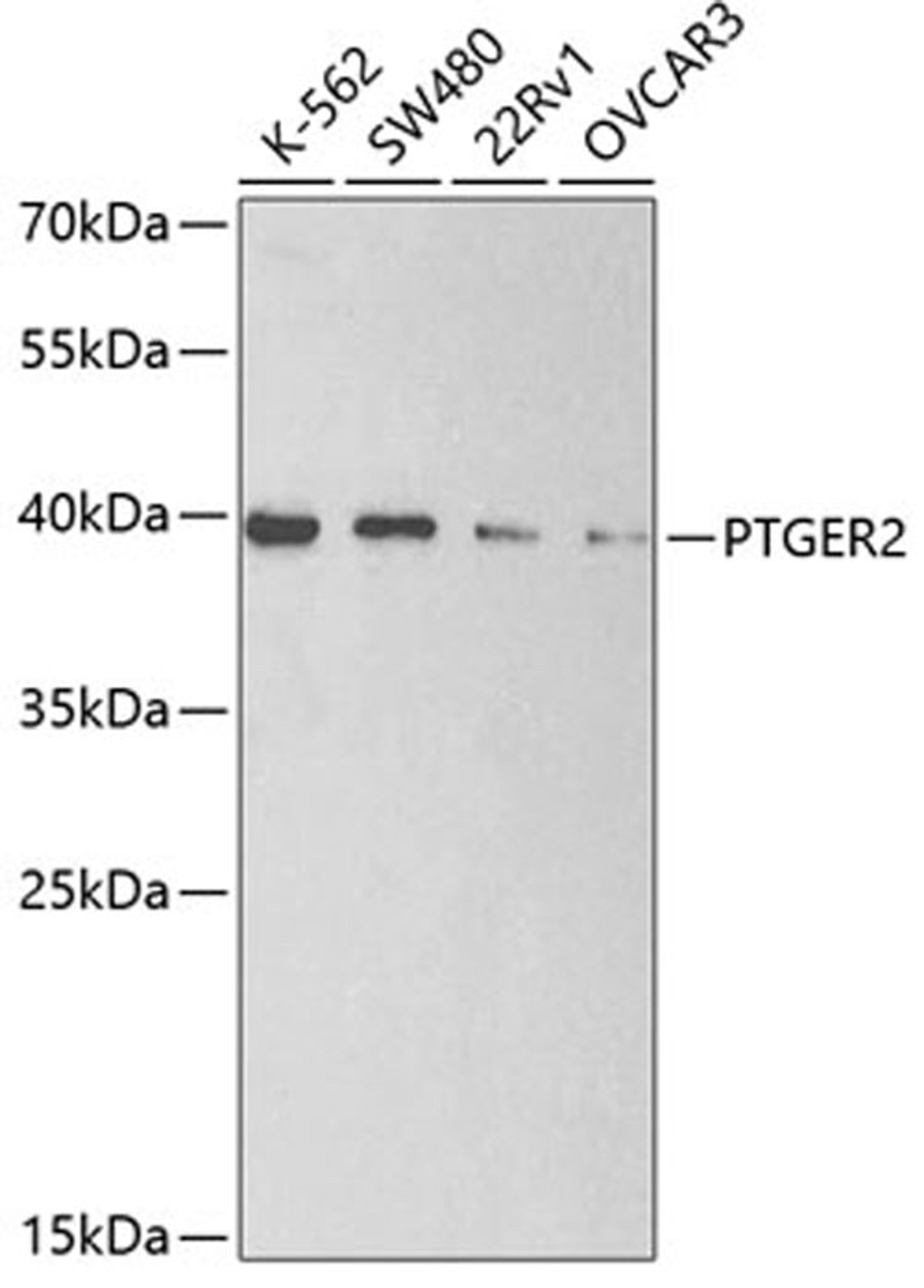 Western blot - PTGER2 antibody (A2914)