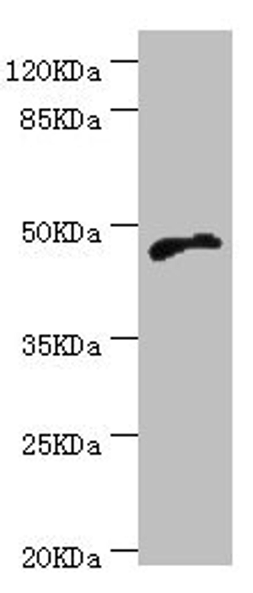 Western blot. All lanes: CYTH2 antibody at 5.1µg/ml + MCF-7 whole cell lysate. Secondary. Goat polyclonal to rabbit IgG at 1/10000 dilution. Predicted band size: 47 kDa. Observed band size: 47 kDa