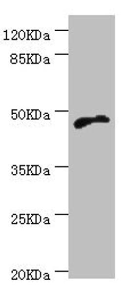Western blot. All lanes: CYTH2 antibody at 5.1µg/ml + MCF-7 whole cell lysate. Secondary. Goat polyclonal to rabbit IgG at 1/10000 dilution. Predicted band size: 47 kDa. Observed band size: 47 kDa