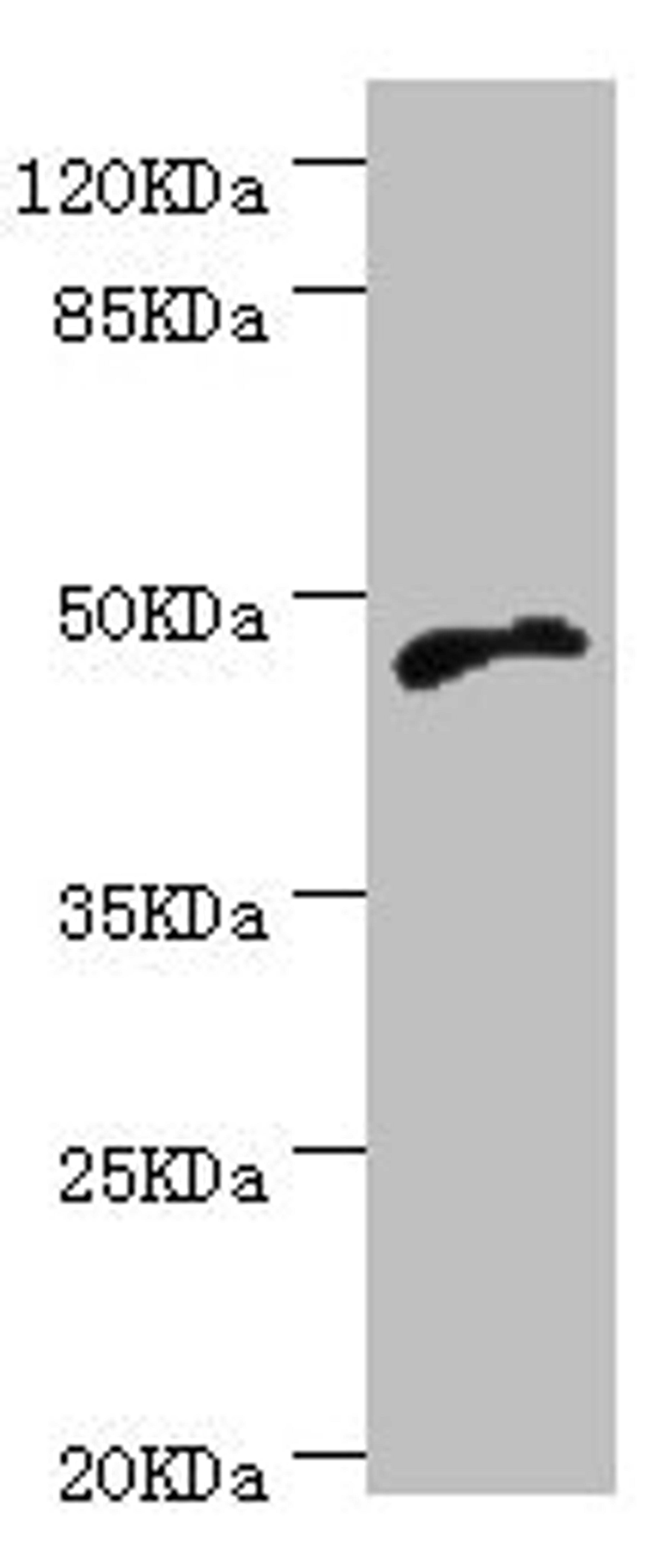 Western blot. All lanes: CYTH2 antibody at 5.1µg/ml + MCF-7 whole cell lysate. Secondary. Goat polyclonal to rabbit IgG at 1/10000 dilution. Predicted band size: 47 kDa. Observed band size: 47 kDa