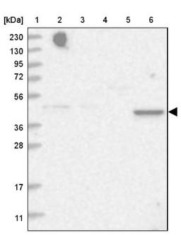 Western Blot: C5orf44 Antibody [NBP1-94021] - Lane 1: Marker [kDa] 230, 130, 95, 72, 56, 36, 28, 17, 11<br/>Lane 2: Human cell line RT-4<br/>Lane 3: Human cell line U-251MG sp<br/>Lane 4: Human plasma (IgG/HSA depleted)<br/>Lane 5: Human liver tissue<br/>Lane 6: Human tonsil tissue