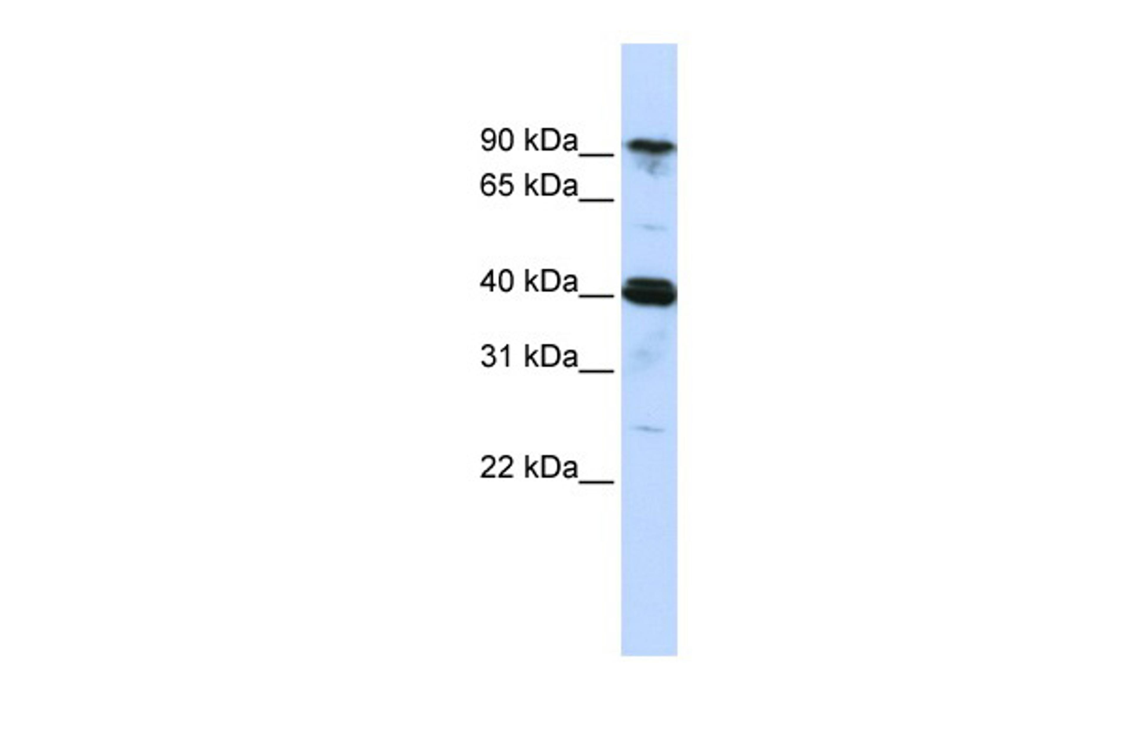 Antibody used in WB on Human MCF-7 at 0.2-1 ug/ml.