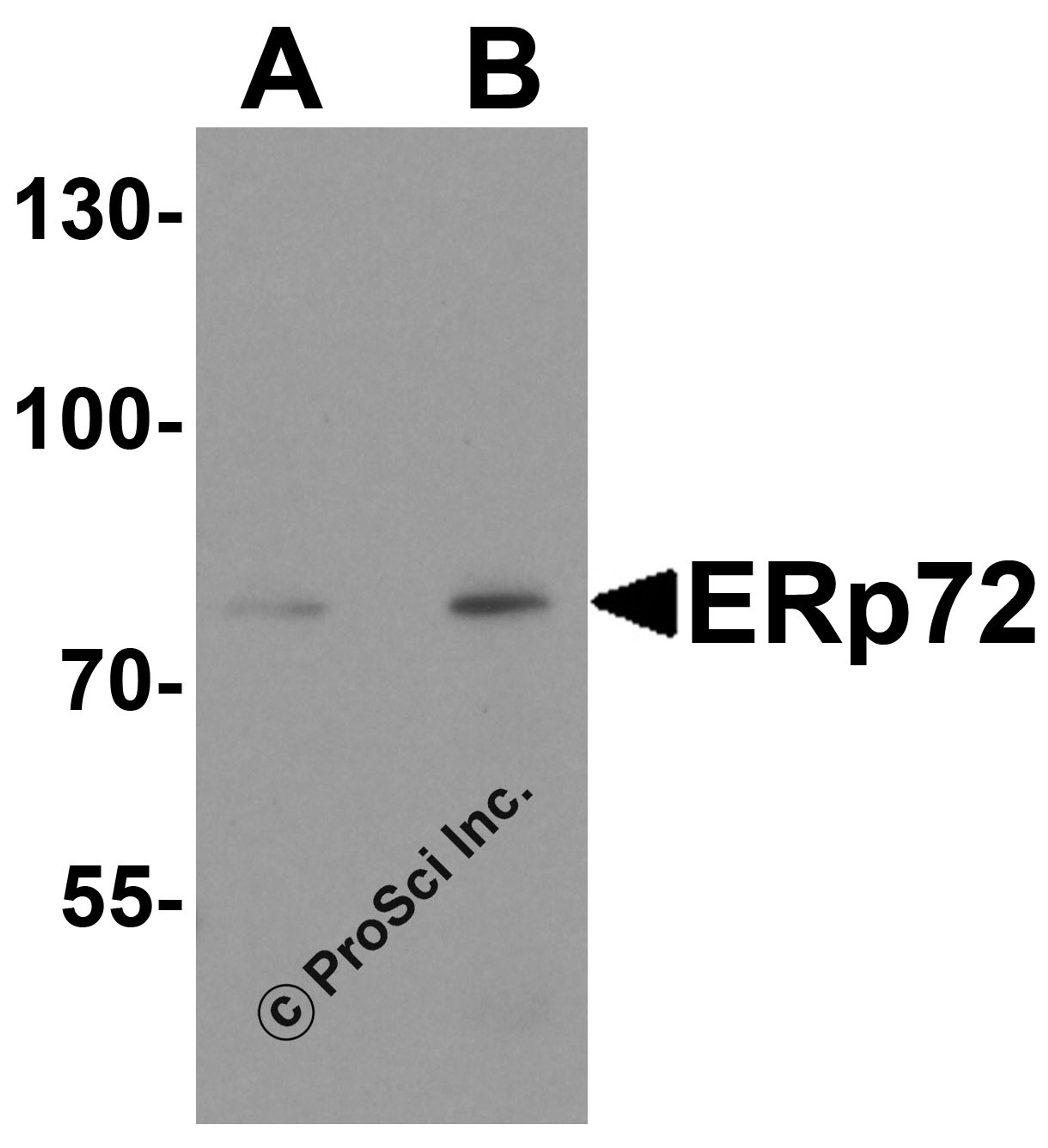 Western blot analysis of ERp72 in human colon tissue lysate with ERp72 antibody at (A) 1 and (B) 2 μg/ml.