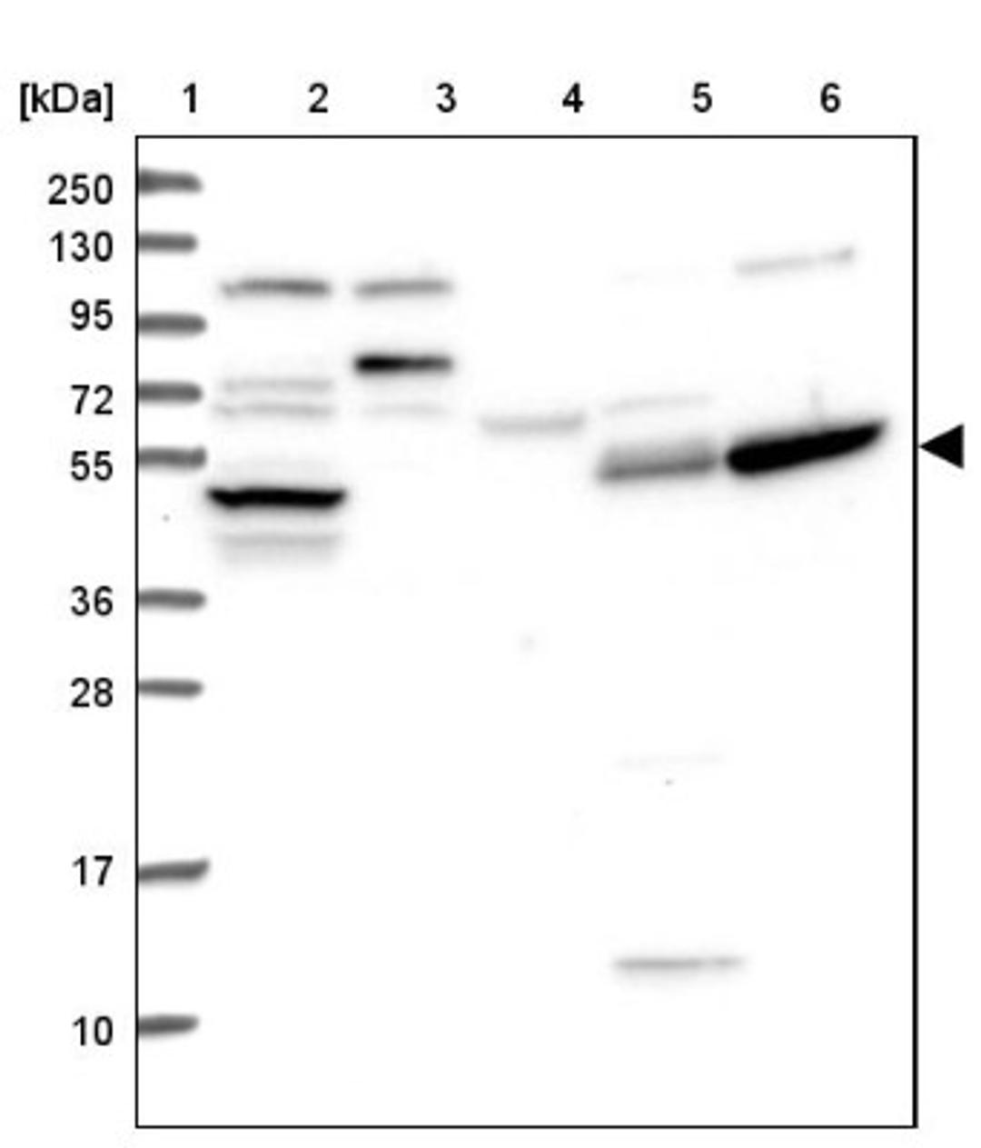 Western Blot: TTC23 Antibody [NBP1-83718] - Lane 1: Marker [kDa] 250, 130, 95, 72, 55, 36, 28, 17, 10<br/>Lane 2: Human cell line RT-4<br/>Lane 3: Human cell line U-251MG sp<br/>Lane 4: Human plasma (IgG/HSA depleted)<br/>Lane 5: Human liver tissue<br/>Lane 6: Human tonsil tissue