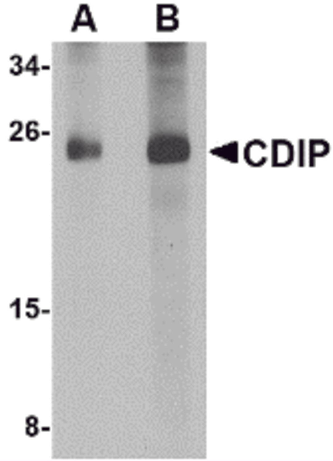 Western blot analysis of CDIP in human brain lysate with CDIP antibody at (A) 1 and (B) 2 &#956;g/mL.