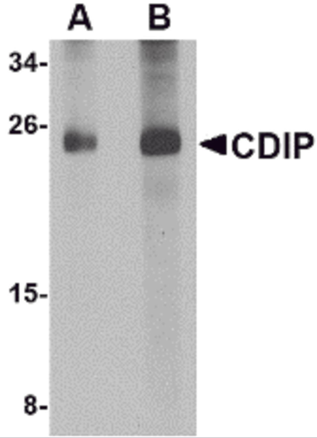 Western blot analysis of CDIP in human brain lysate with CDIP antibody at (A) 1 and (B) 2 μg/mL.