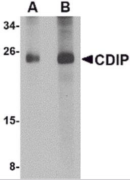 Western blot analysis of CDIP in human brain lysate with CDIP antibody at (A) 1 and (B) 2 μg/mL.