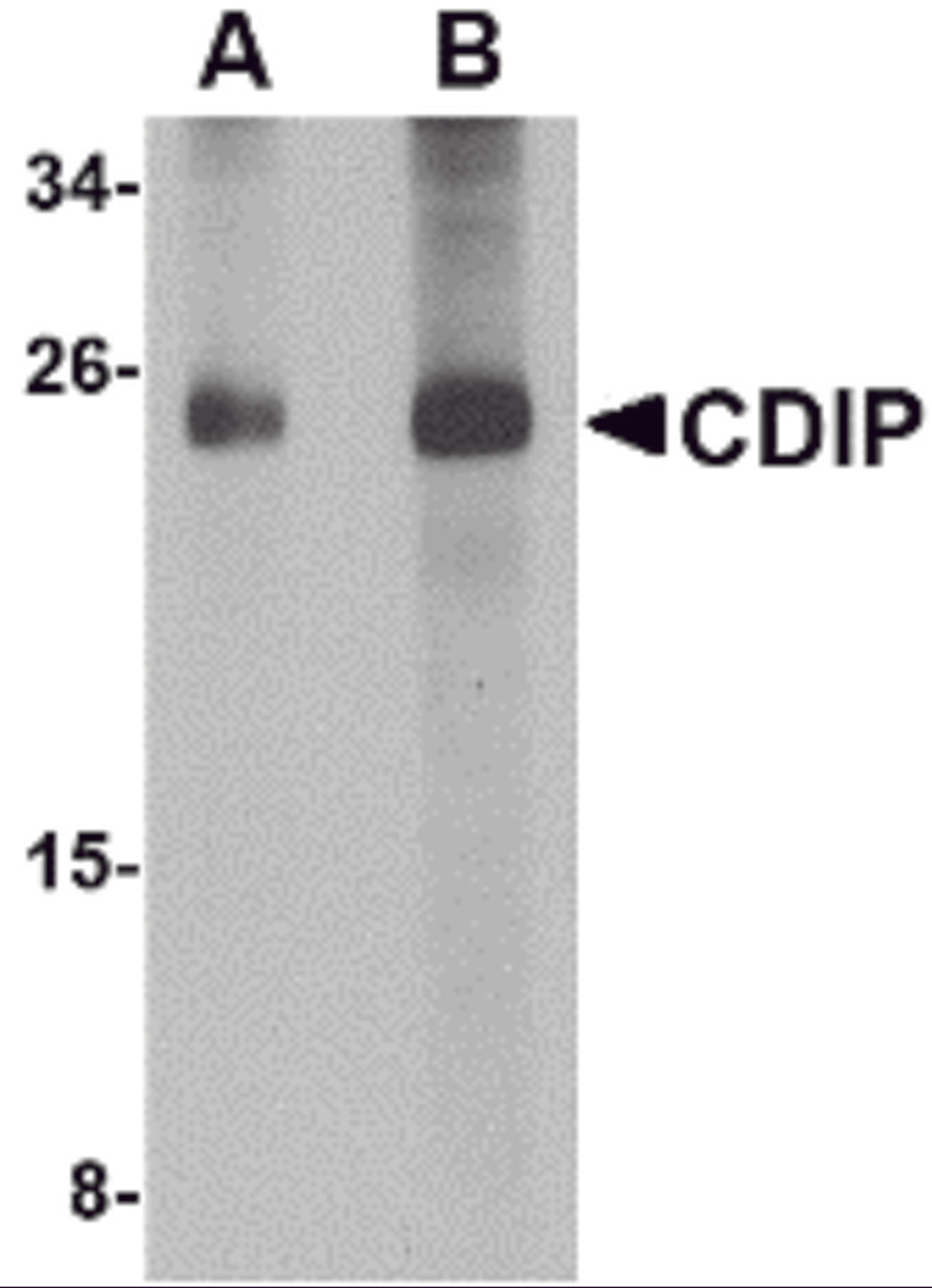 Western blot analysis of CDIP in human brain lysate with CDIP antibody at (A) 1 and (B) 2 μg/mL.