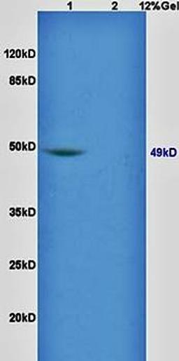 Western blot analysis of rat brain lysates (Lane1), rat liver lysates (Lane2) dilution at:1:200 using GATA4 antibody