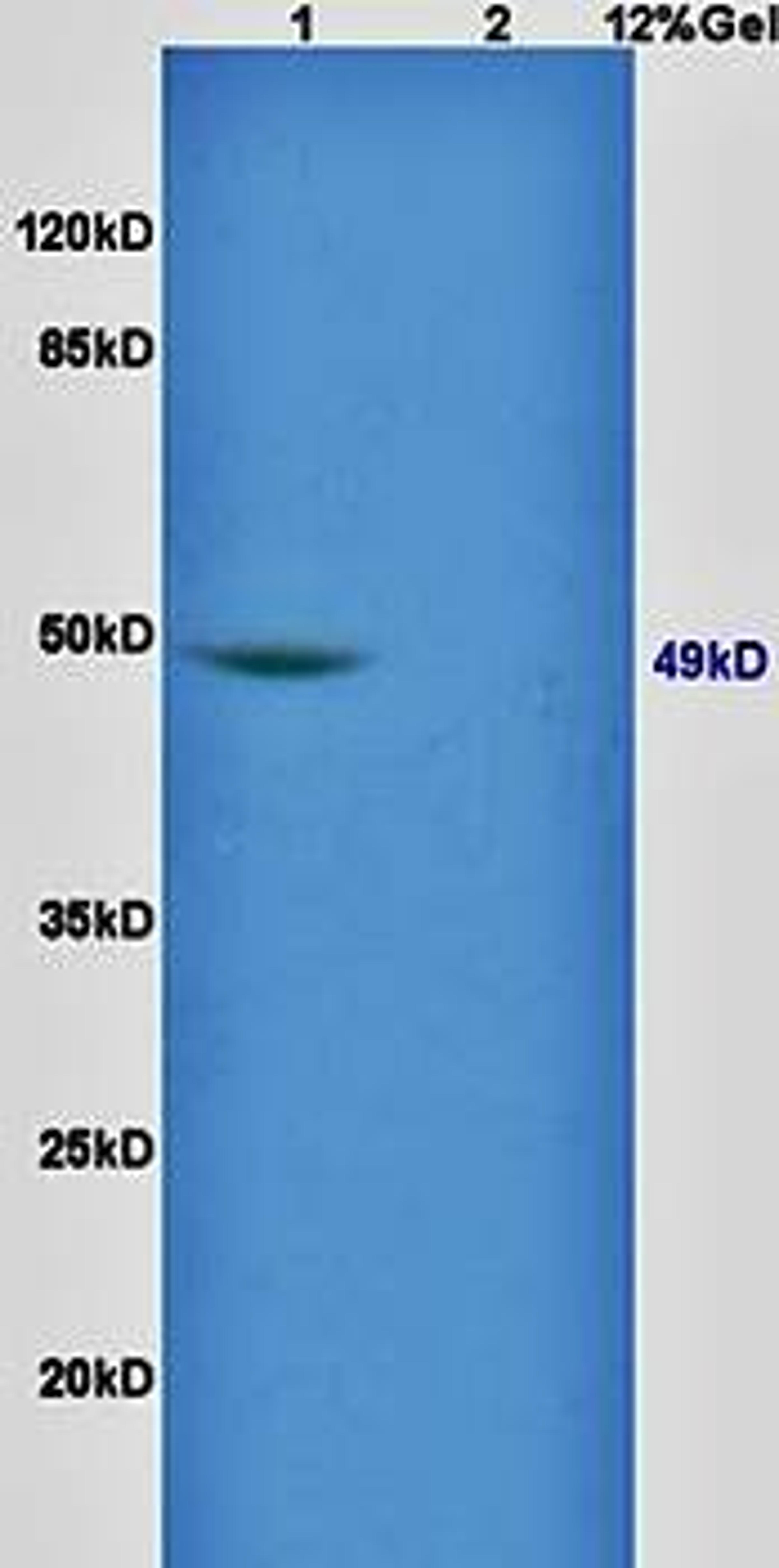 Western blot analysis of rat brain lysates (Lane1), rat liver lysates (Lane2) dilution at:1:200 using GATA4 antibody