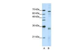 Antibody used in WB on Human HepG2 at 5.0 ug/ml.