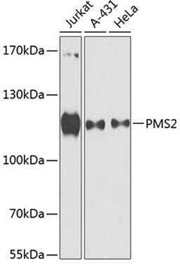 Western blot - PMS2 antibody (A13680)