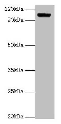 Western blot. All lanes: HK1 antibody at 2µg/ml + Rat brain tissue. Secondary. Goat polyclonal to rabbit IgG at 1/15000 dilution. Predicted band size: 103, 102 kDa. Observed band size: 103 kDa