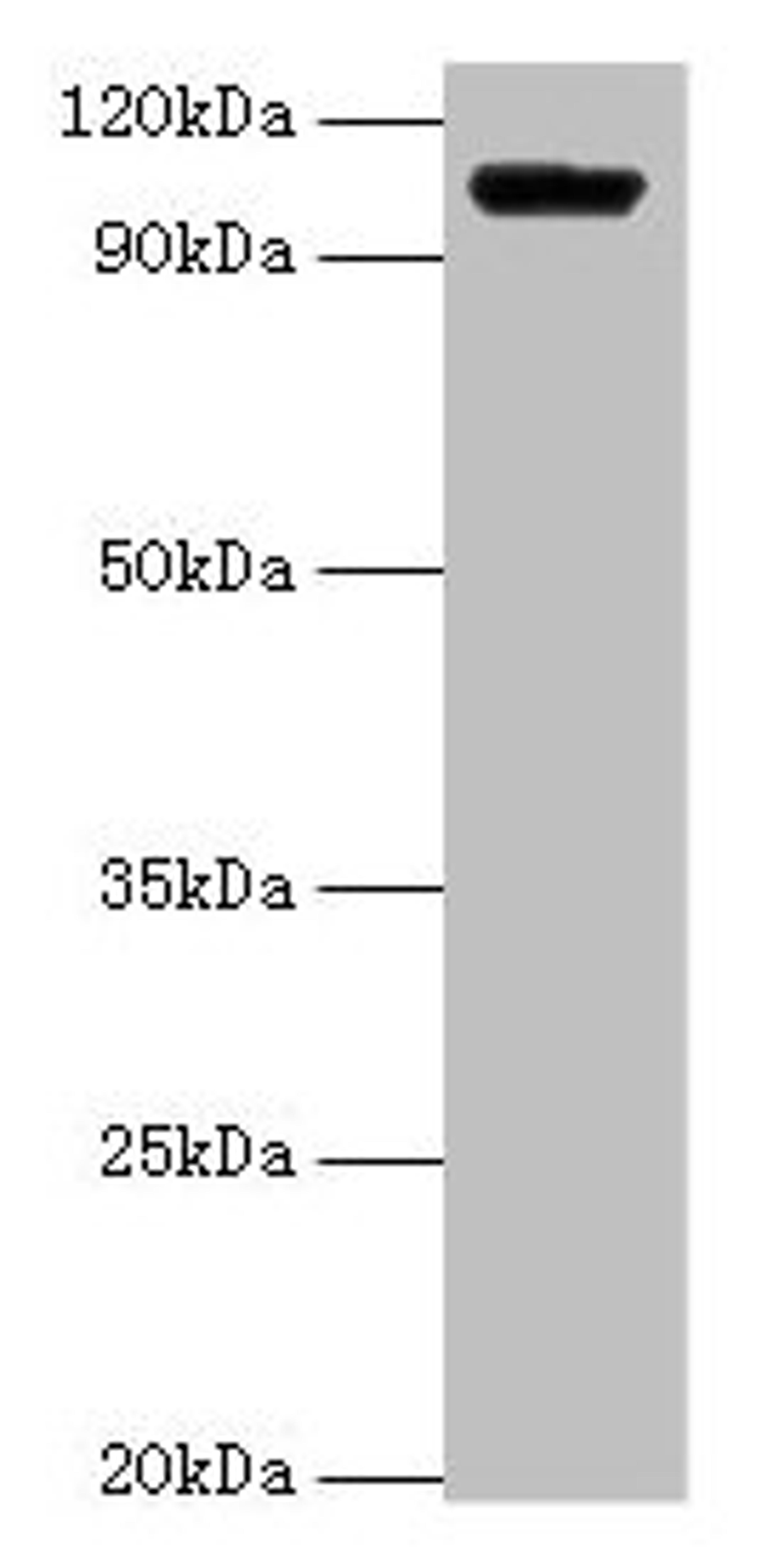 Western blot. All lanes: HK1 antibody at 2µg/ml + Rat brain tissue. Secondary. Goat polyclonal to rabbit IgG at 1/15000 dilution. Predicted band size: 103, 102 kDa. Observed band size: 103 kDa