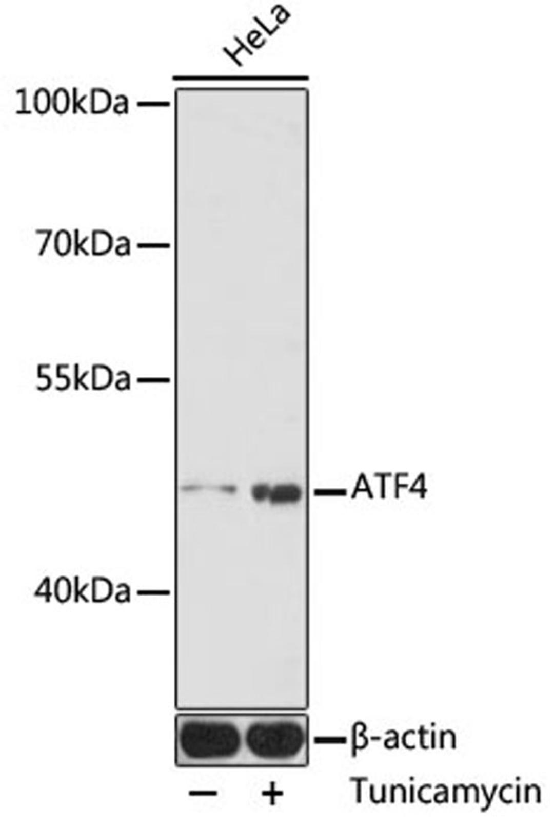 Western blot - ATF4 antibody (A0201)