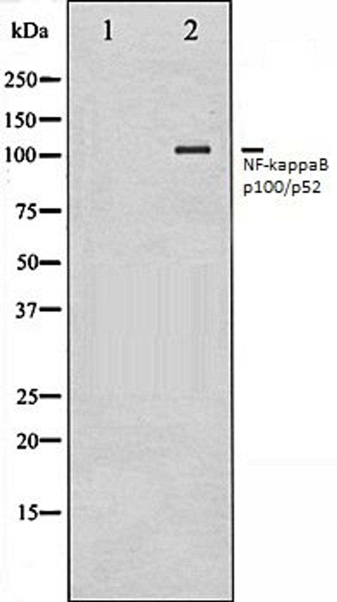 Western blot analysis of ovarycancer whole cell lysates using NF-kappaB p100/p52 antibody, The lane on the left is treated with the antigen-specific peptide.