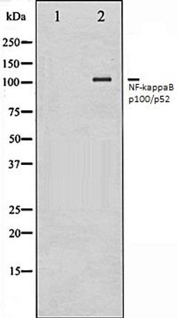 Western blot analysis of ovarycancer whole cell lysates using NF-kappaB p100/p52 antibody, The lane on the left is treated with the antigen-specific peptide.