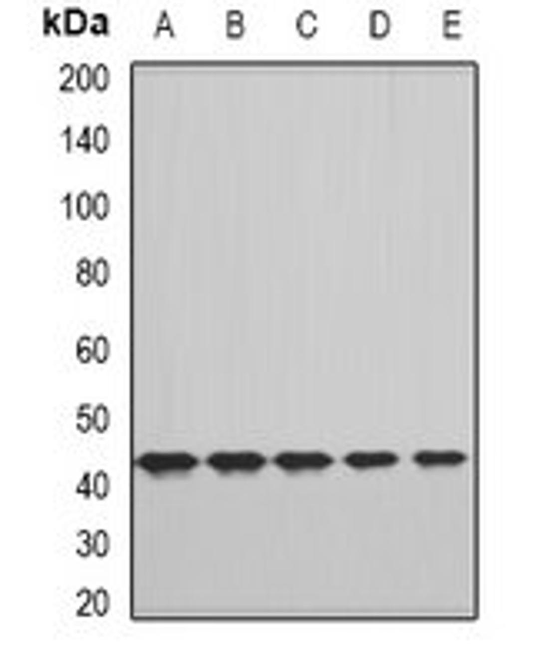 Western blot analysis of A549 (Lane1), HepG2 (Lane2), NIH3T3 (Lane3), mouse liver (Lane4), rat liver (Lane5) whole cell lysates using CFHR3 antibody