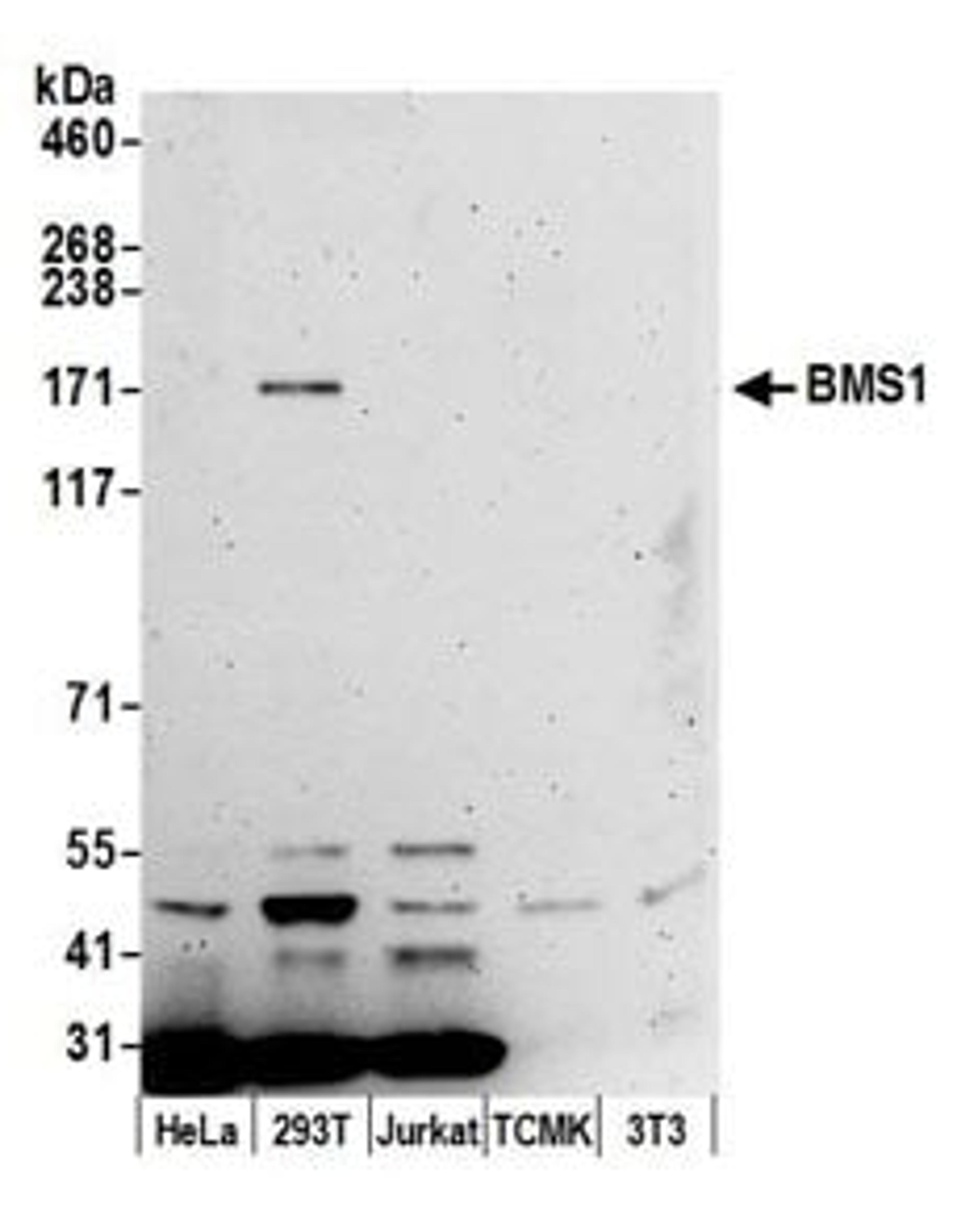 Detection of human BMS1 by western blot.