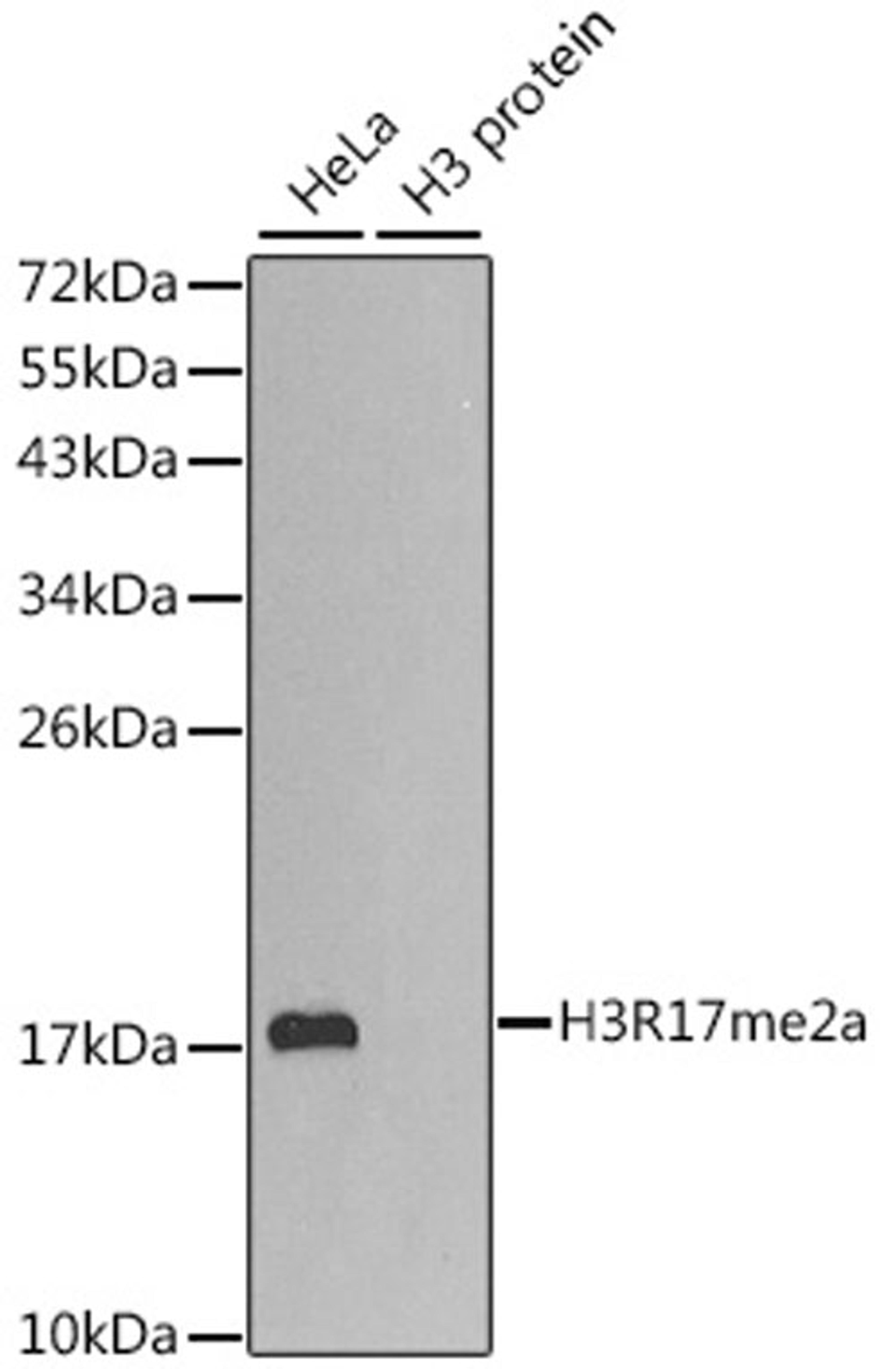 Western blot - Asymmetric DiMethyl-Histone H3-R17 antibody (A2421)