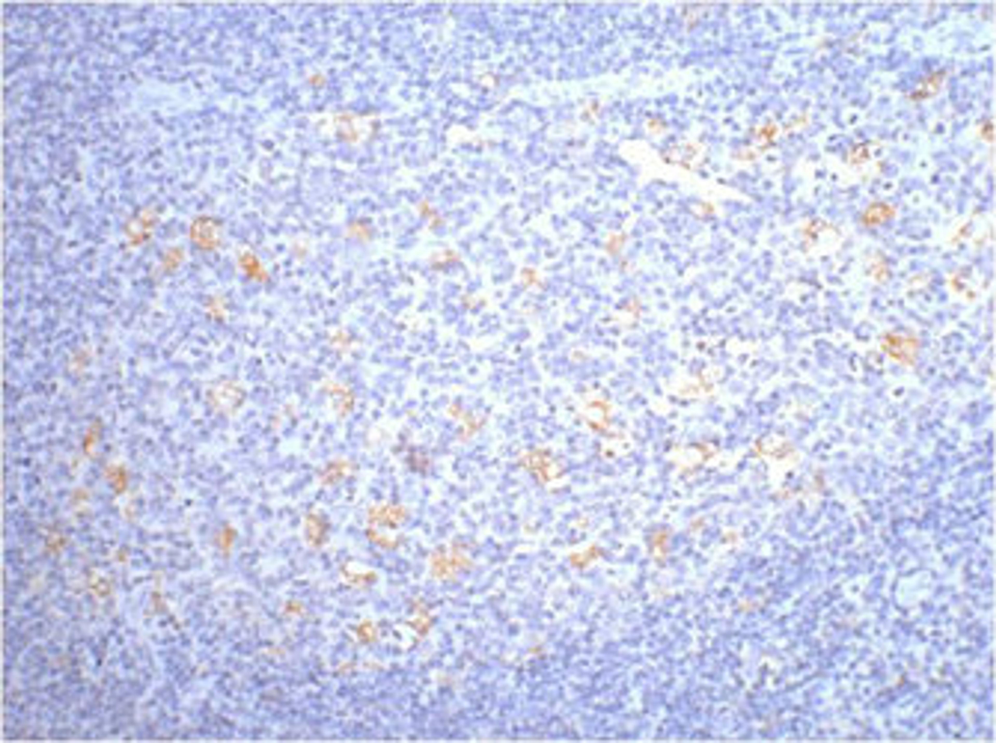 IHC staining of human tonsil tissue, diluted at 1:200.