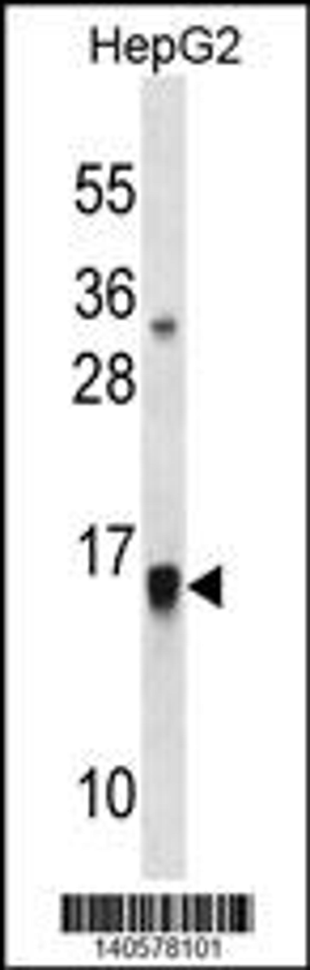 Western blot analysis in HepG2 cell line lysates (35ug/lane).