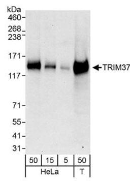 Detection of human TRIM37 by western blot.