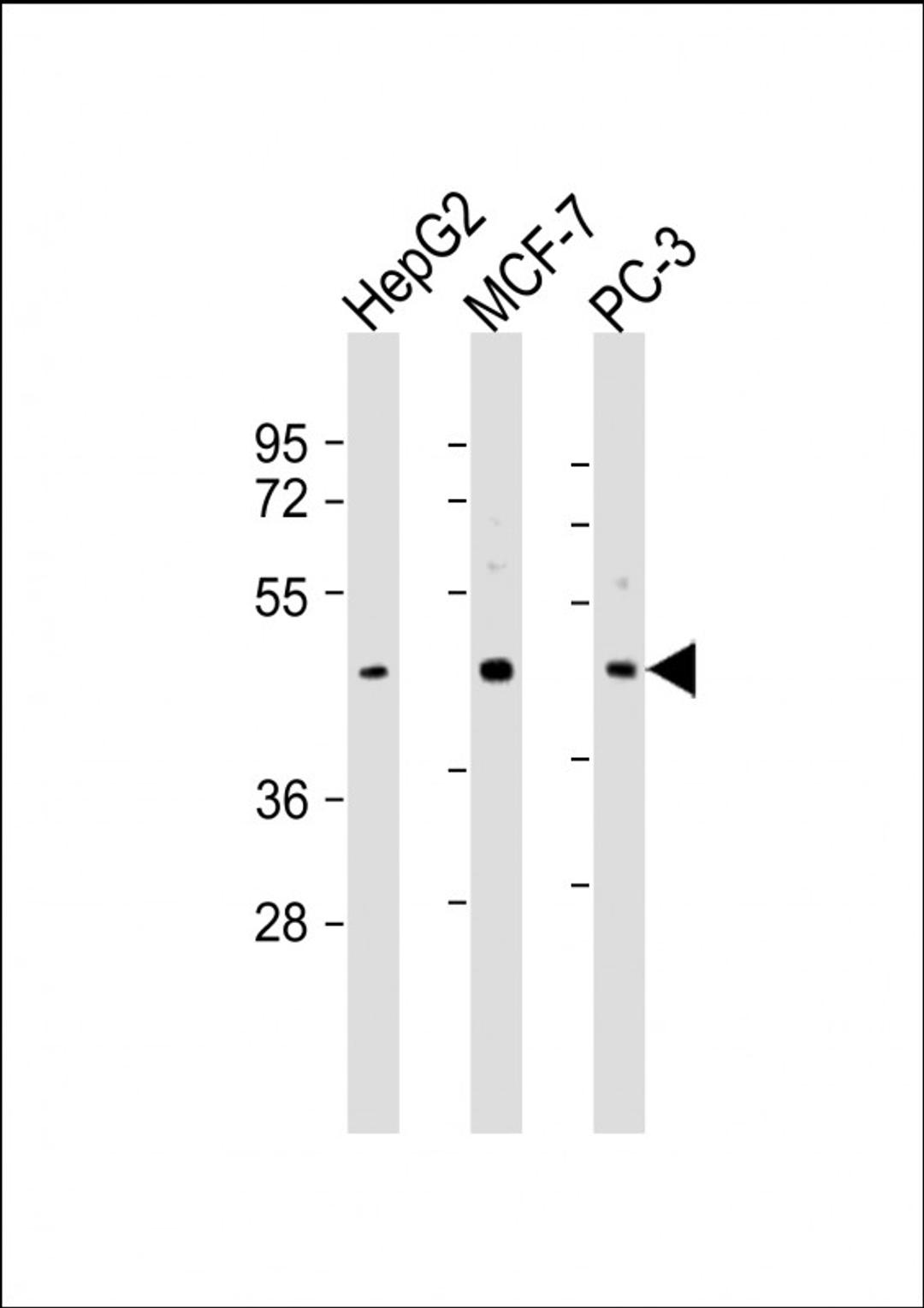 Western Blot at 1:2000 dilution Lane 1: HepG2 whole cell lysate Lane 2: MCF-7 whole cell lysate Lane 3: PC-3 whole cell lysate Lysates/proteins at 20 ug per lane.