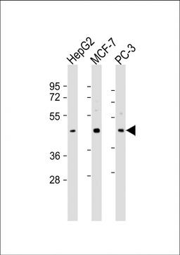 Western Blot at 1:2000 dilution Lane 1: HepG2 whole cell lysate Lane 2: MCF-7 whole cell lysate Lane 3: PC-3 whole cell lysate Lysates/proteins at 20 ug per lane.